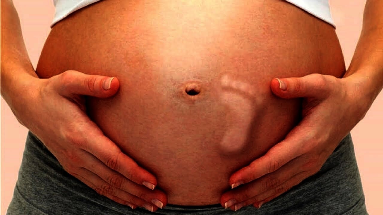 Abdomen distendido embarazo