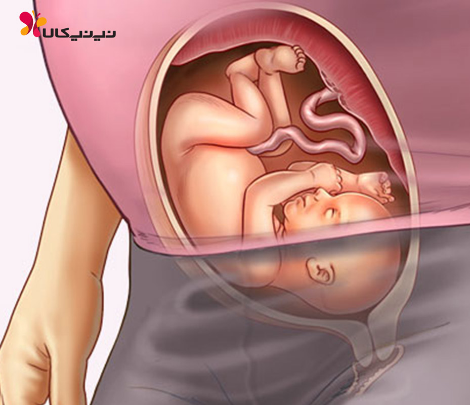 Ребенок плачет в утробе. Расположение ребенка на 36 неделе. Расположение малыша в животе.